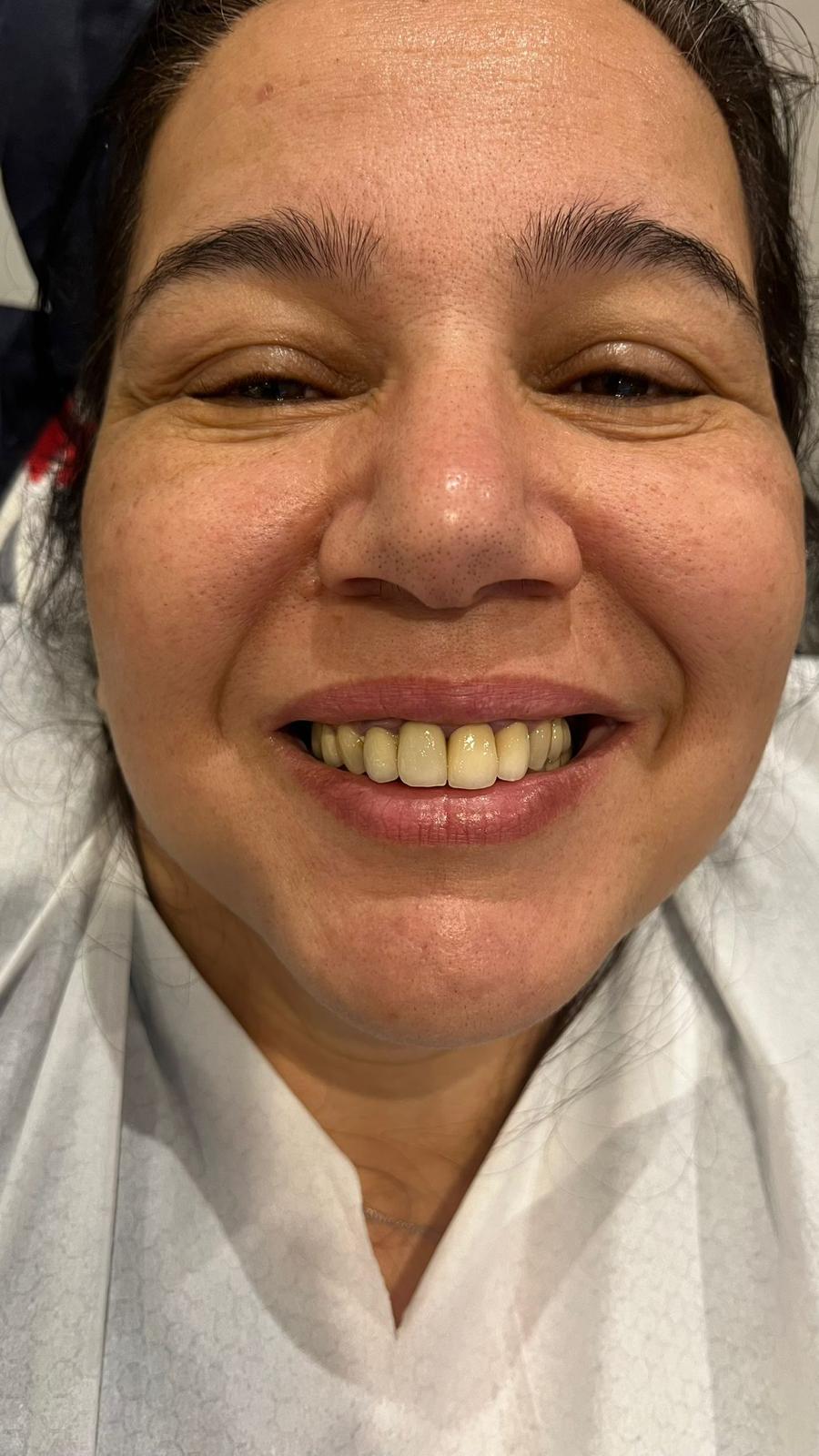 ECE Dental Patient Transformation